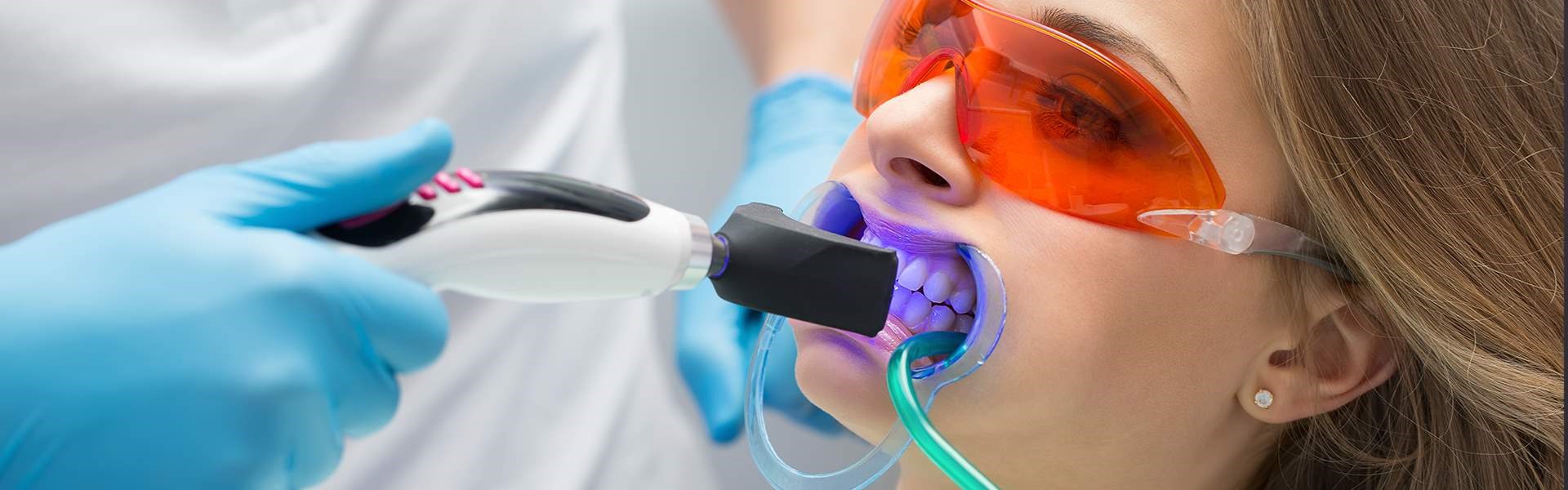 Are teeth sensitive after whitening