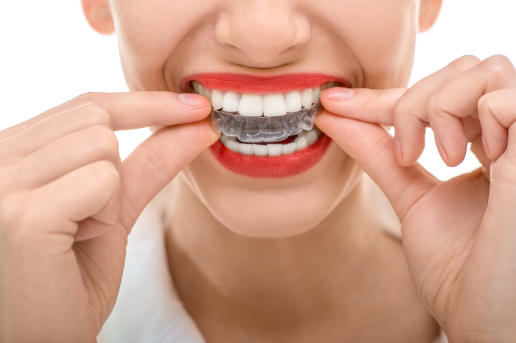 self teeth straightening